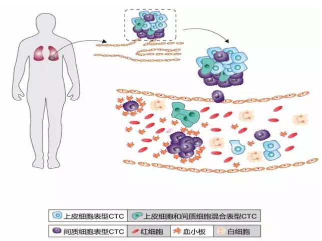 CTC循環(huán)腫瘤細(xì)胞的分類