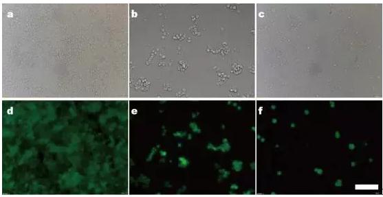 Figure 4 Optical and fluorescence microscopy images of HCT116 cells treated with unloaded microparticles (a, d), only CPT-loaded microparticles (b, e), and DOX-CPT-co-loaded microparticles (c, f) for 24 h, respectively. The scale bar is 50 μm. Figure 4 Optical and fluorescence microscopy images of HCT116 cells treated with unloaded microparticles (a, d), only CPT-loaded microparticles (b, e), and DOX-CPT-co-loaded microparticles (c, f) for 24 h, respectively. The scale bar is 50 μm.