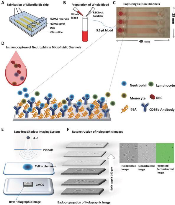 監(jiān)控血液中嗜中性粒細胞數量的新方法