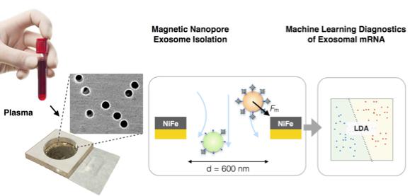 納米流控技術(shù)與機器學(xué)習(xí)相結(jié)合利用外泌體精確診斷胰腺癌