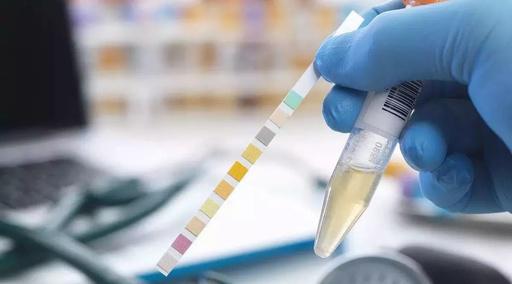 現(xiàn)場快速檢測 現(xiàn)場快速檢測