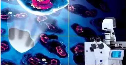 激光顯微切割技術(shù)（LCM）