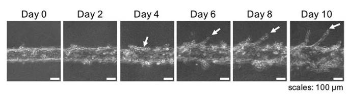 隨著時(shí)間的推移，可以用顯微鏡觀察到血管的新生。圖片來源：EBioMedicine