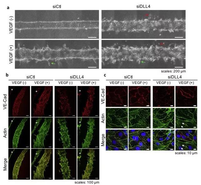 敲除DLL4將影響血管的新生和穩(wěn)定性。圖片來源：EBioMedicine