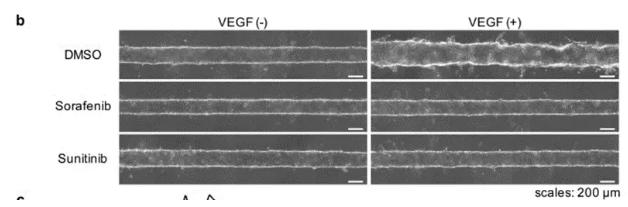 向芯片中添加抗腫瘤藥物sorafenib或sunitinib，觀察到了血管新生的抑制現(xiàn)象。 圖片來源：EBioMedicine