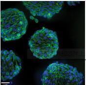 3D細(xì)胞培養(yǎng)微流控芯片 3D細(xì)胞培養(yǎng)微流控芯片