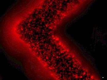 細胞外囊泡（紅色）從患者腫瘤細胞中釋放并被捕獲在EV-HB芯片表面。