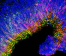 由3D細胞培養(yǎng)產(chǎn)生的新生視網(wǎng)膜