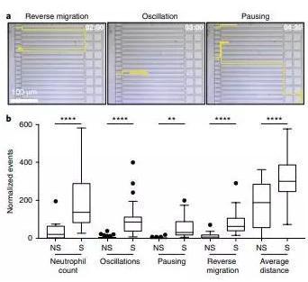 敗血癥特異性的中性粒細(xì)胞自發(fā)的遷移模式。