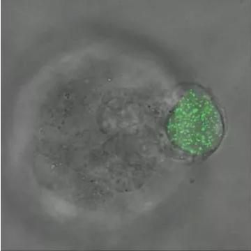 華中科大研發(fā)出測(cè)量三維生物力的新技術(shù)，有望用于癌癥早期診斷
