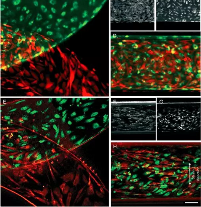 紡錘形細(xì)胞