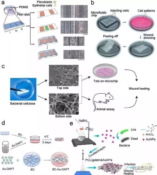 圖7.基于微流控芯片的傷口愈合模型和傷口敷料篩選。