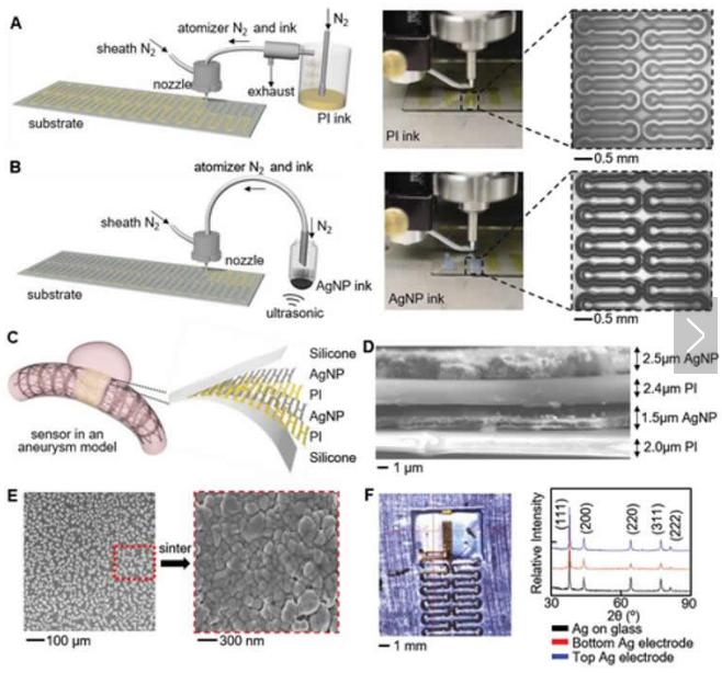 可拉伸的無(wú)線傳感器可以監(jiān)測(cè)腦動(dòng)脈瘤的愈合