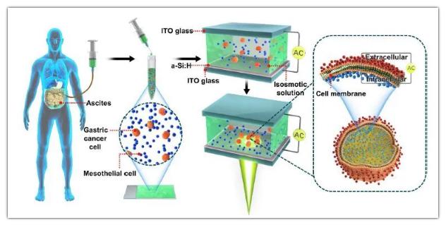 OEK微流控芯片用于檢測腹膜轉(zhuǎn)移和細胞膜電容 OEK微流控芯片用于檢測腹膜轉(zhuǎn)移和細胞膜電容